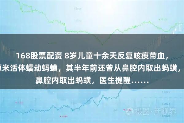 168股票配资 8岁儿童十余天反复咳痰带血，气管内取出8厘米活体蠕动蚂蟥，其半年前还曾从鼻腔内取出蚂蟥，医生提醒……